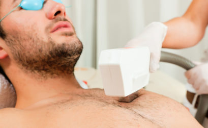 Epilation homme laser