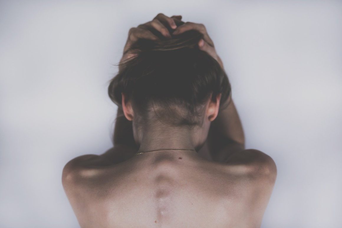 calvitie de la femme