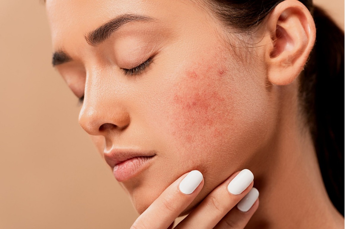 crème visage